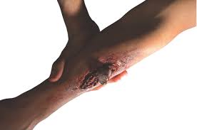Theatrical Effects - Broken Bone